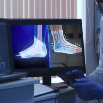 Calcetines De Neuro Compresión - Sereni Vida™.
